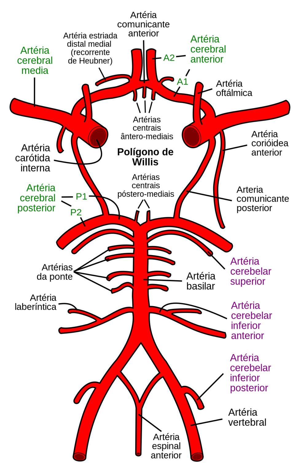 Aneurisma Cerebral Dr Marcos