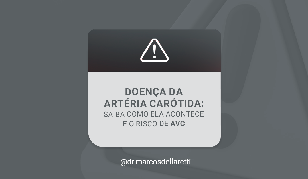 Doença da Artéria Carótida: saiba como ela acontece e o risco de AVC