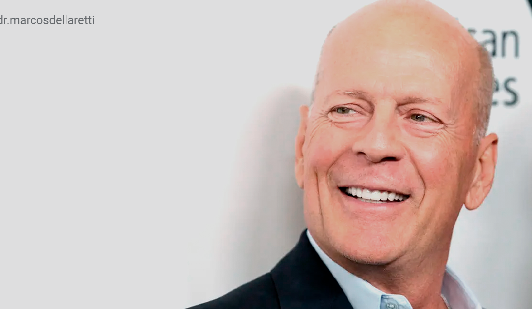 Entenda a doença que afeta o ator Bruce Willis: demência frontotemporal