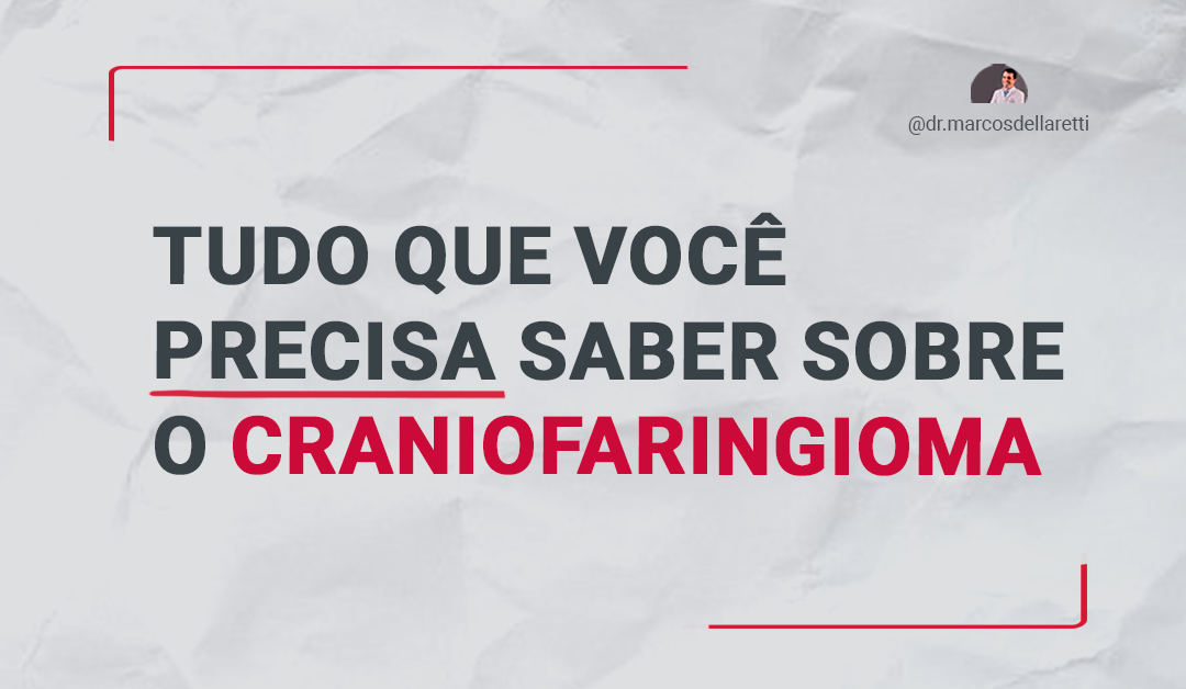 Tudo que você precisa saber sobre o craniofaringioma