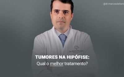 Tumores na hipófise: qual o melhor tratamento?