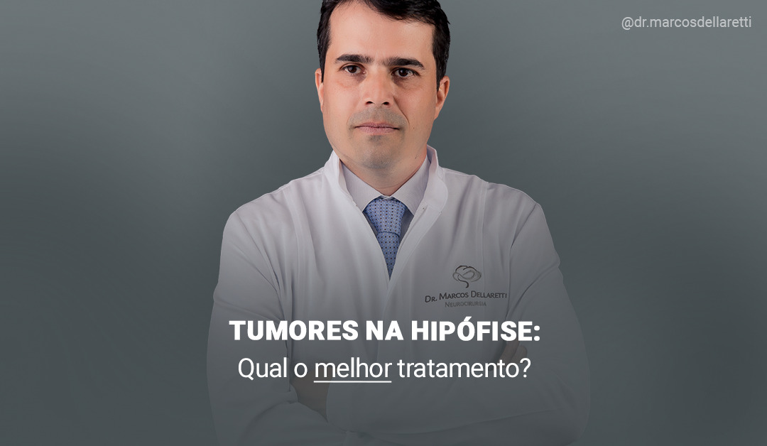 Tumores na hipófise: qual o melhor tratamento?