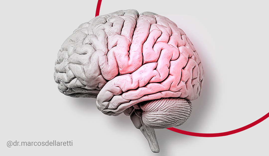 Glioblastoma: pesquisadores brasileiros estudam forma de clonar tumor e personalizar o tratamento