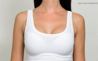 Por que o tumor na hipófise pode causar a produção de leite fora da gravidez?