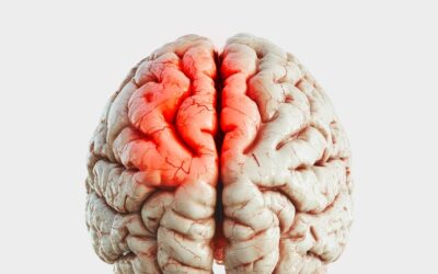 Mudanças cerebrais em silêncio: sinais que podem indicar a presença de um glioma