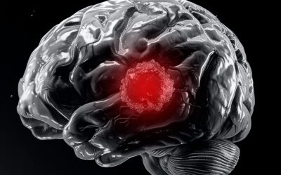 Metástases cerebrais: o combate multidisciplinar e a importância do timing no tratamento