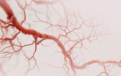 O perigo silencioso: por que a Malformação Arteriovenosa (MAV) pode passar anos sem sintomas?