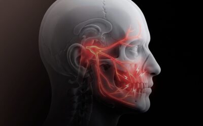 Descompressão microvascular: quando a cirurgia pode devolver qualidade de vida a quem convive com a neuralgia do trigêmeo