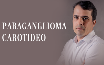 Paraganglioma carotídeo: um tumor que pode comprometer a artéria que irriga o cérebro